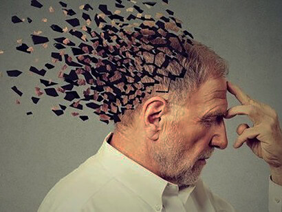Attualmente i trattamenti disponibili per l'Alzheimer sono pochi 