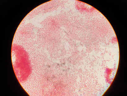 Salmonella. En el caso de Salmonella, los fagos han demostrado eficacia en infecciones gastrointestinales al reducir la carga bacteriana sin efectos adversos graves