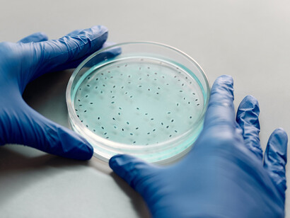 Bactéries. Les bactéries sont des êtres microscopiques ayant fait leur apparition sur le devant de la scène scientifico-médiatique à partir du milieu du XIXe siècle