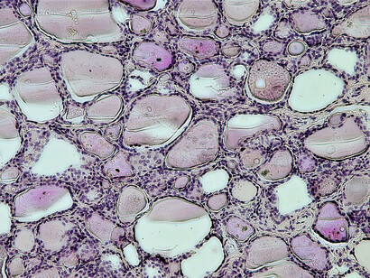 El funcionamiento de la glándula tiroides es un proceso coordinado y regulado que comienza en una pequeña parte de tu cerebro llamada la glándula pituitaria. Sección transversal, aumento: 100x, tinción con hematoxilina y eosina. Lúmenes rellenos de coloide en la glándula tiroides humana