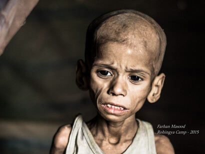A Rohingya child