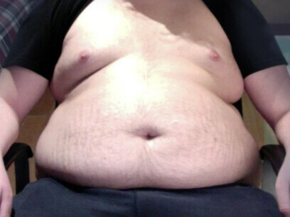 Los mayores aumentos se produjeron principalmente en países de ingresos bajos y medios. Adolescente obeso,16 años, peso 136 kg