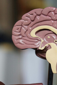 High-protein and high-fat diets play a crucial role in stroke recovery, acting as a brain sculptor for improved healing and rehabilitation