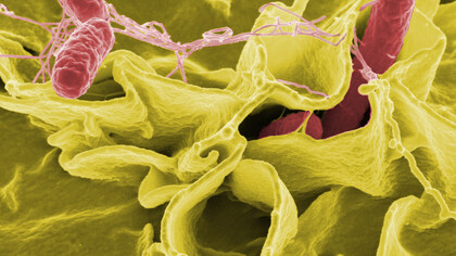 Micrografía electrónica con colores realzados que muestra a la especie 'Salmonella enterica' (células rojas) invadiendo células humanas en cultivo