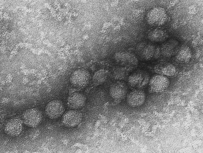Virus del Nilo Occidental perteneciente al orden Flaviviridae