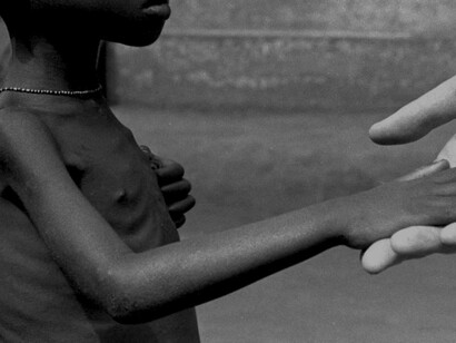 Millones de personas sufren malnutrición en el mundo