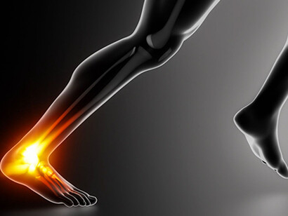 Un infortunio alla caviglia