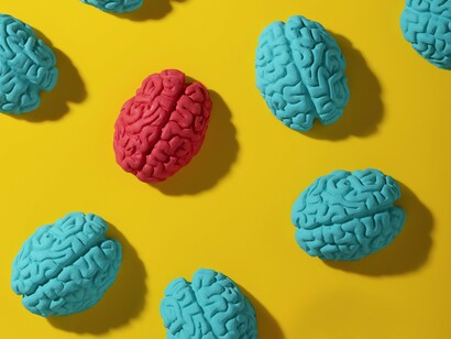 Pensar em inclusão na sociedade envolve uma mudança do paradigma de igualdade para o de equidade. Em um ambiente escolar em que todos os alunos são tratados da mesma maneira, sem distinção, não existe equidade, que consiste em tratar cada pessoa de acordo com a capacidade que lhe é inerente, tendo em vista que cada pessoa possui características únicas; algumas possuem deficiência