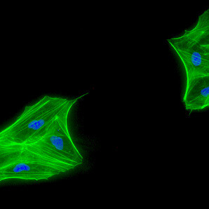 La clonación terapéutica se centra en la creación de células madre embrionarias para tratar enfermedades