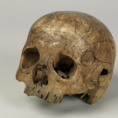 Scientific Instruments and the History of Medicine. Courtesy of GNM