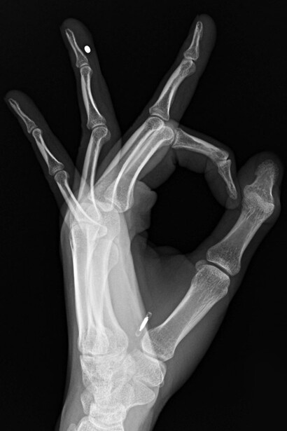 Esas neuroarmas pueden darse bajo la forma de agentes biológicos, o de armas químicas, así como de energía dirigida. Todo ello puede maquillarse, presentándose como mejoras en el campo de la biotecnología