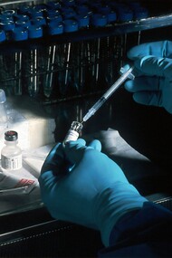 El Virus Sincicial Respiratorio es una de las principales amenazas respiratorias a nivel mundial, con alto impacto en la salud pública