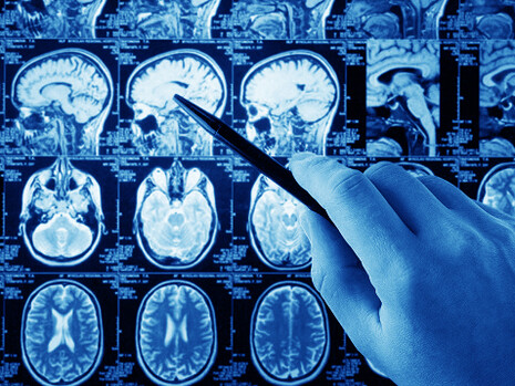 Con il nuovo paradigma l’impostazione teorico-scientifica e la dimensione concreta e pratica della medicina si incontrano stimolando la riflessione sulla corretta definizione di salute e malattia