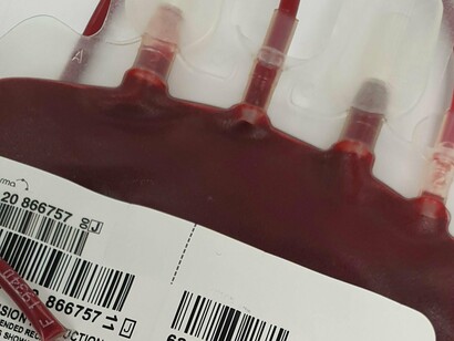 Bolsa de sangue. Na maioria dos casos, as doações são destinadas a pessoas conhecidas que precisam de doadores. Em estudos realizados no Brasil, foi demonstrado que as pessoas entendem a importância de doar, mas não entendem bem o procedimento



