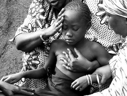 Mutilazioni genitali femminili. La mutilazione genitale femminile si riferisce a pratiche di origine tribali che comportano la rimozione parziale o totale dei genitali esterni femminili o altri tipi di lesioni ai genitali femminili per motivi non medici