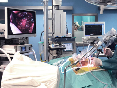 Cirugía endoscópica de columna