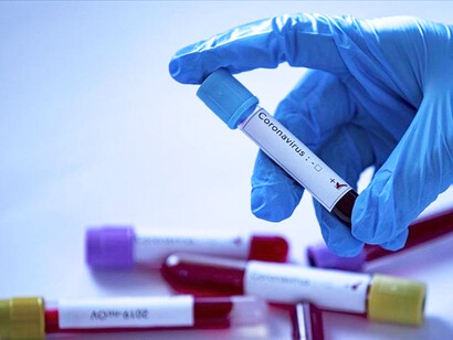 Tenemos la ilusión de que, los medicamentos antivirales, en especial los orales, nos ayuden a combatir el virus