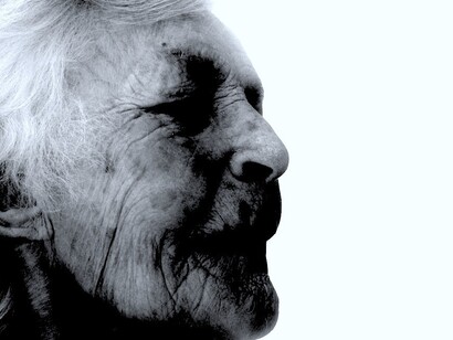 La enfermedad de Alzheimer es la forma más común de demencia