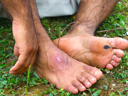 Los pies del refugiado. Foto de Iván Llop