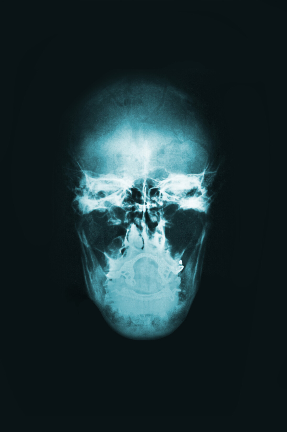 Alexander de Cadenet, The Genius, 2015