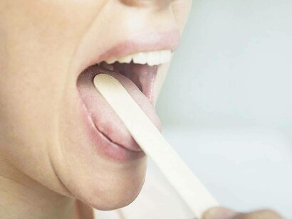 A doctor is flattening the tongue with a tongue compressor on his female patient as a mandatory measure so as to explore the cause of sore throat whether it's due to acid reflux, bacteria, virus, or allergy