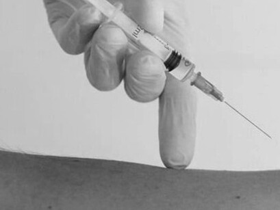 Los médicos lo miran con aparatos, le oyen el corazón, los pulmones, y le hacen que abra la boca bien grande y que saque la lengua