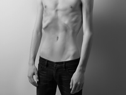 Cuerpo de un joven afectado por la anorexia