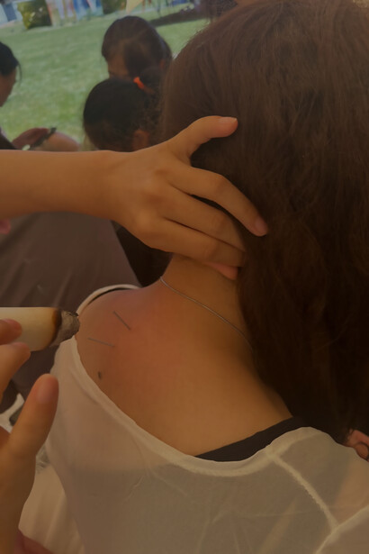 Experience the therapeutic benefits of acupuncture therapy focused on relieving tension and discomfort in the neck and wrists in China