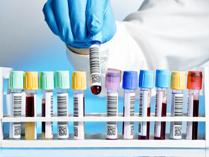 Analisi di laboratorio