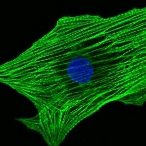 Las células madre tienen la capacidad de diferenciarse en casi cualquier tipo de célula en el cuerpo