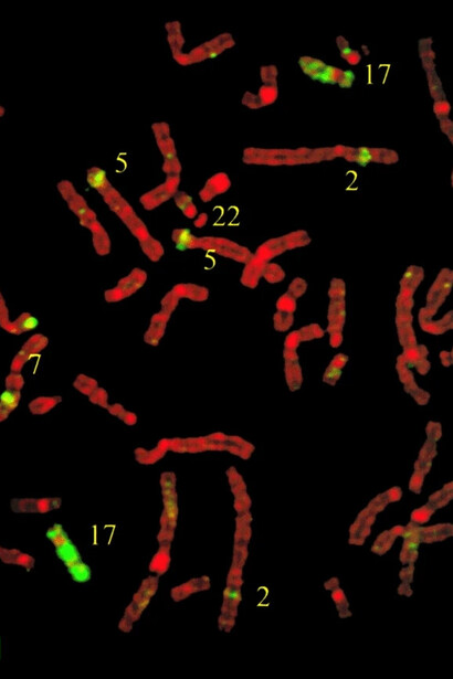 Métaphase humaine peinte avec une sonde du chromosome 11 de souris montre des signaux d'hybridation sur plusieurs chromosomes humains, mais aucun signal sur le chromosome 12, 7 octobre 2022. Par Ferguson-Smith, M.A., Pereira, J.C., Borges, A. et al.