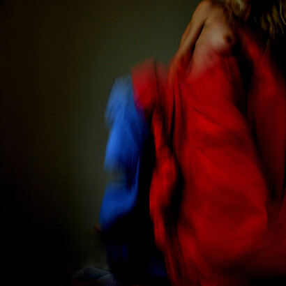 Retinoblastoma 02 ©Ilaria Facci