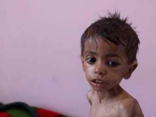 Las estampas que deja la guerra y el olvido de Yemen