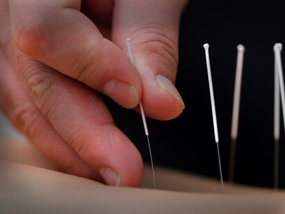 Qin Yueren is considered the father of Chinese medicine and acupuncture