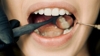 Dental examination taking place