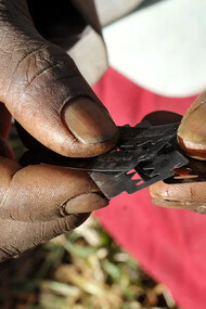 Infibulation. Bien que la pratique des mutilations génitales féminines soit interdite par la loi dans de nombreux pays, il existe une minorité de médecins qui les pratiquent clandestinement