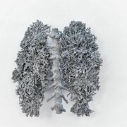 Paolo Grassino, S.T. 2008, Fusioni, alluminio, 81 x 64 x 37cm