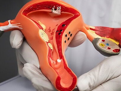 Hand holding uterus and ovary model: detailed anatomical demonstration