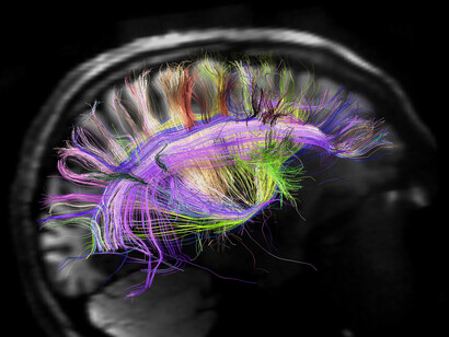 El sistema nervioso y el cerebro
