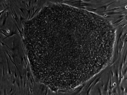 Science meets healing—these stem cells may hold the key to reversing inflammation and joint degeneration
