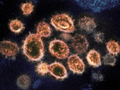 El virus SARS-COV-2 bajo el microscopio