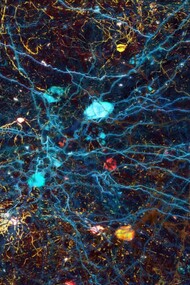 Le neurotecnologie sono dispositivi in grado di registrare, decodificare e/o modificare l’attività del cervello