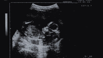 Infanticide, cover