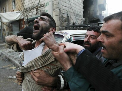 El dolor de la guerra en Siria