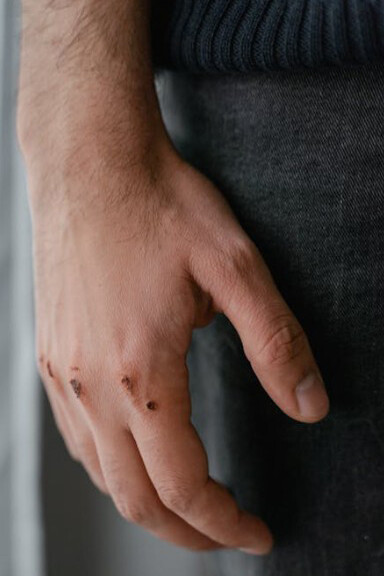 A close-up shot of a wounded hand clenched into a fist