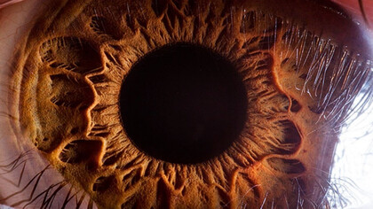 Eye Closeup by Suren Manvelyan