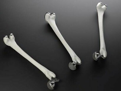3D printed printed hip and knee implants credit Science Museum and Renishaw plc