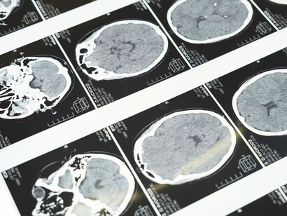 El laboratorio clínico ya no se limita a entregar resultados, sino que se convierte en un nodo estratégico de información dentro del ecosistema digital de salud