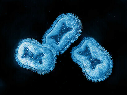 Monkeypox-Virus unter einem Mikroskop