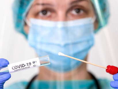The SARS-CoV-2 virus that causes Covid-19 could have appeared before December, 2020 in the USA